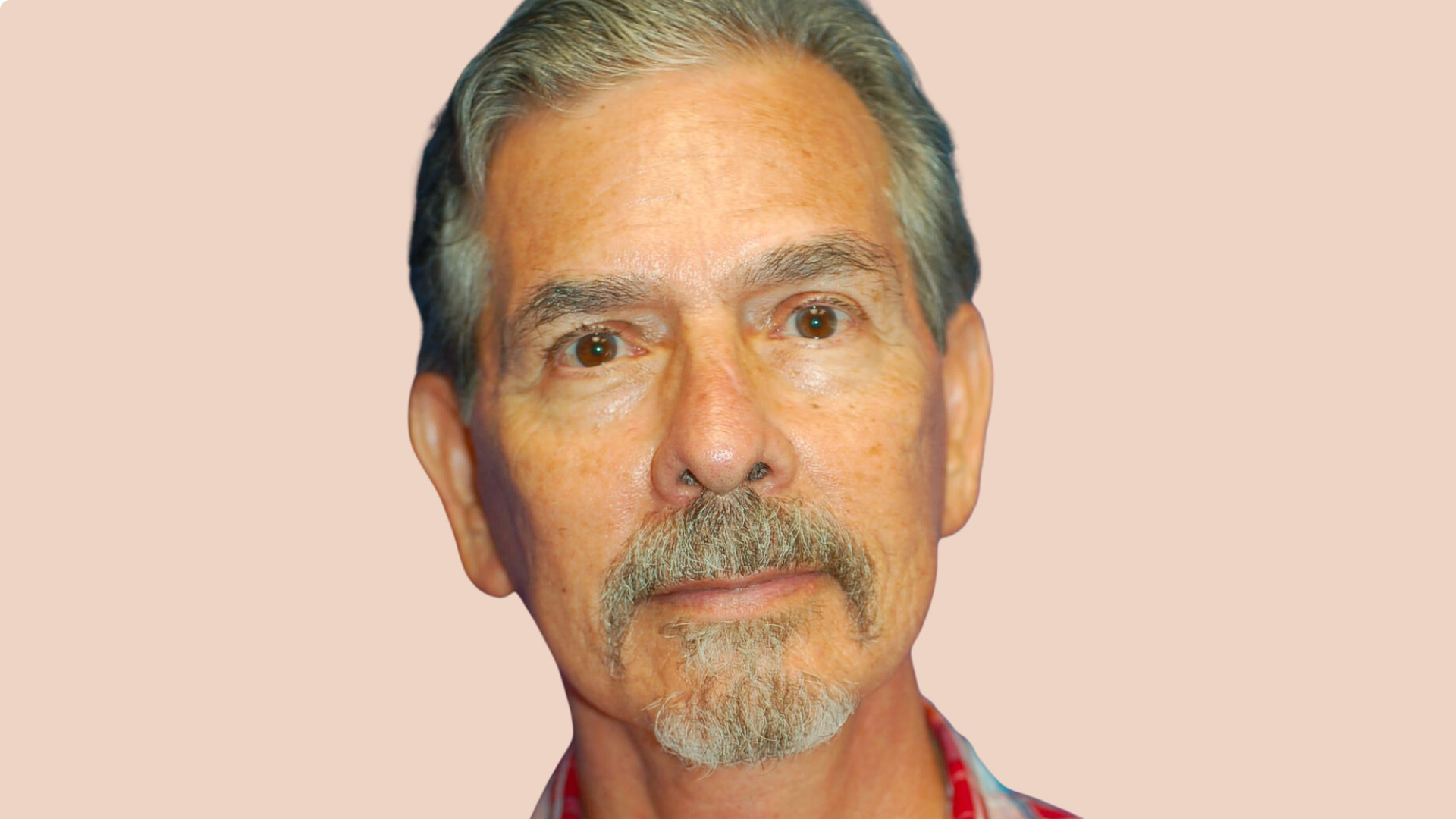 Facelift after image